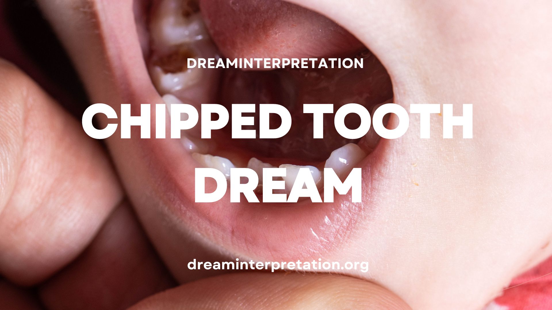 Chipped Tooth Dream (Interpretation & Spiritual Meaning)