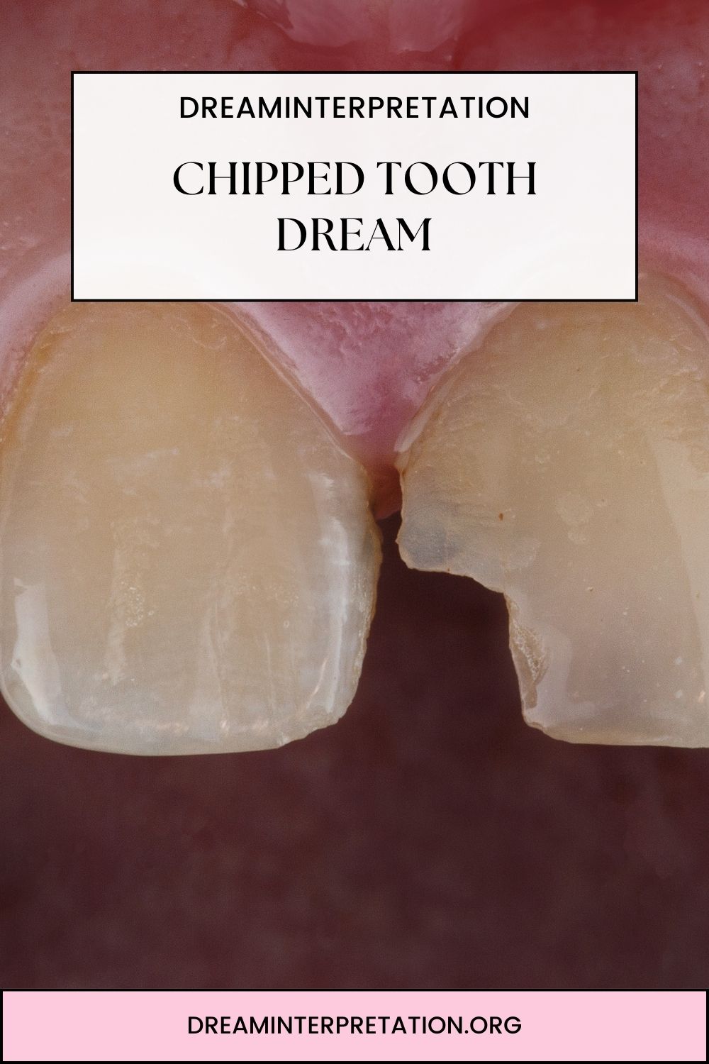 Chipped Tooth Dream pin 1