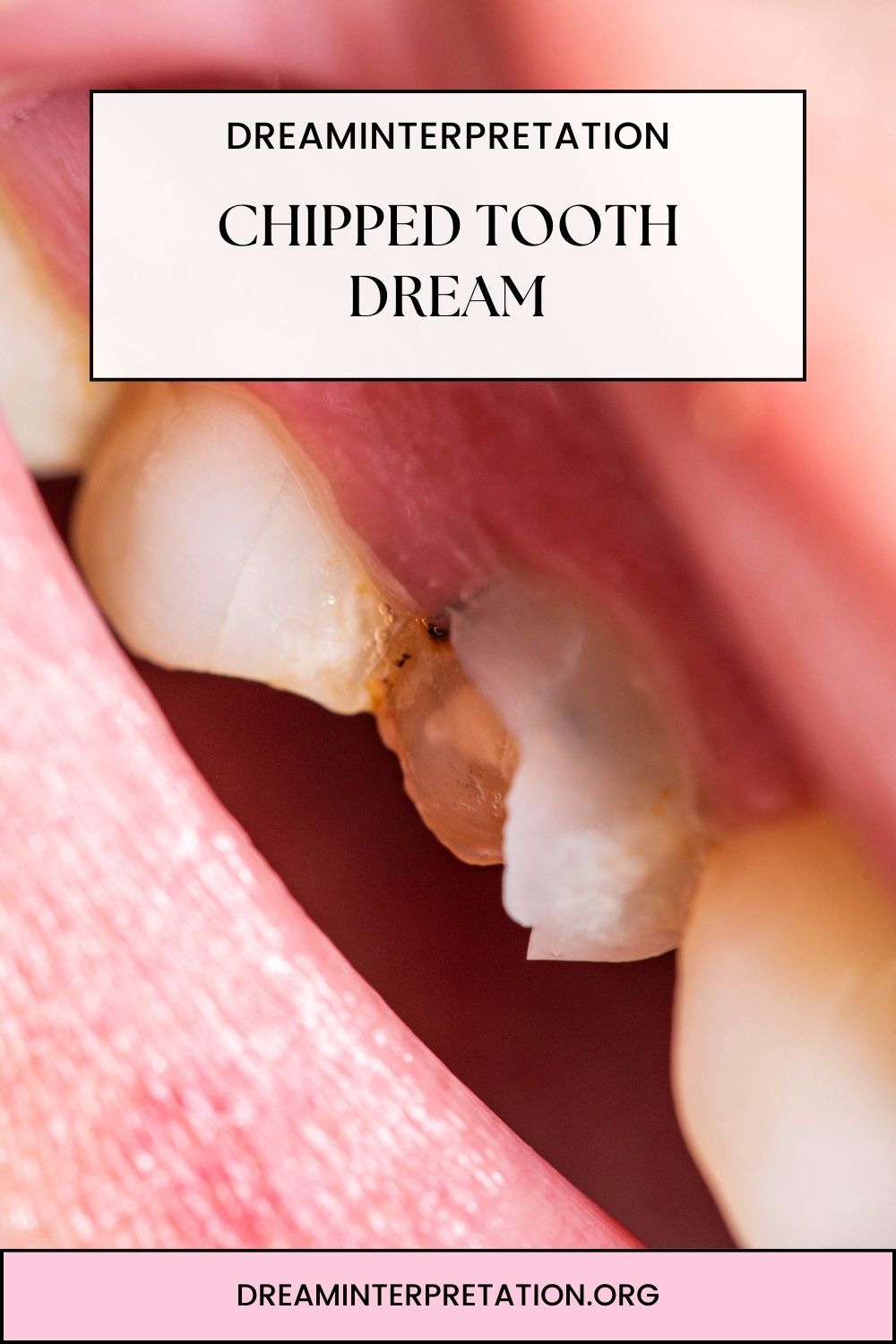 Chipped Tooth Dream pin 2