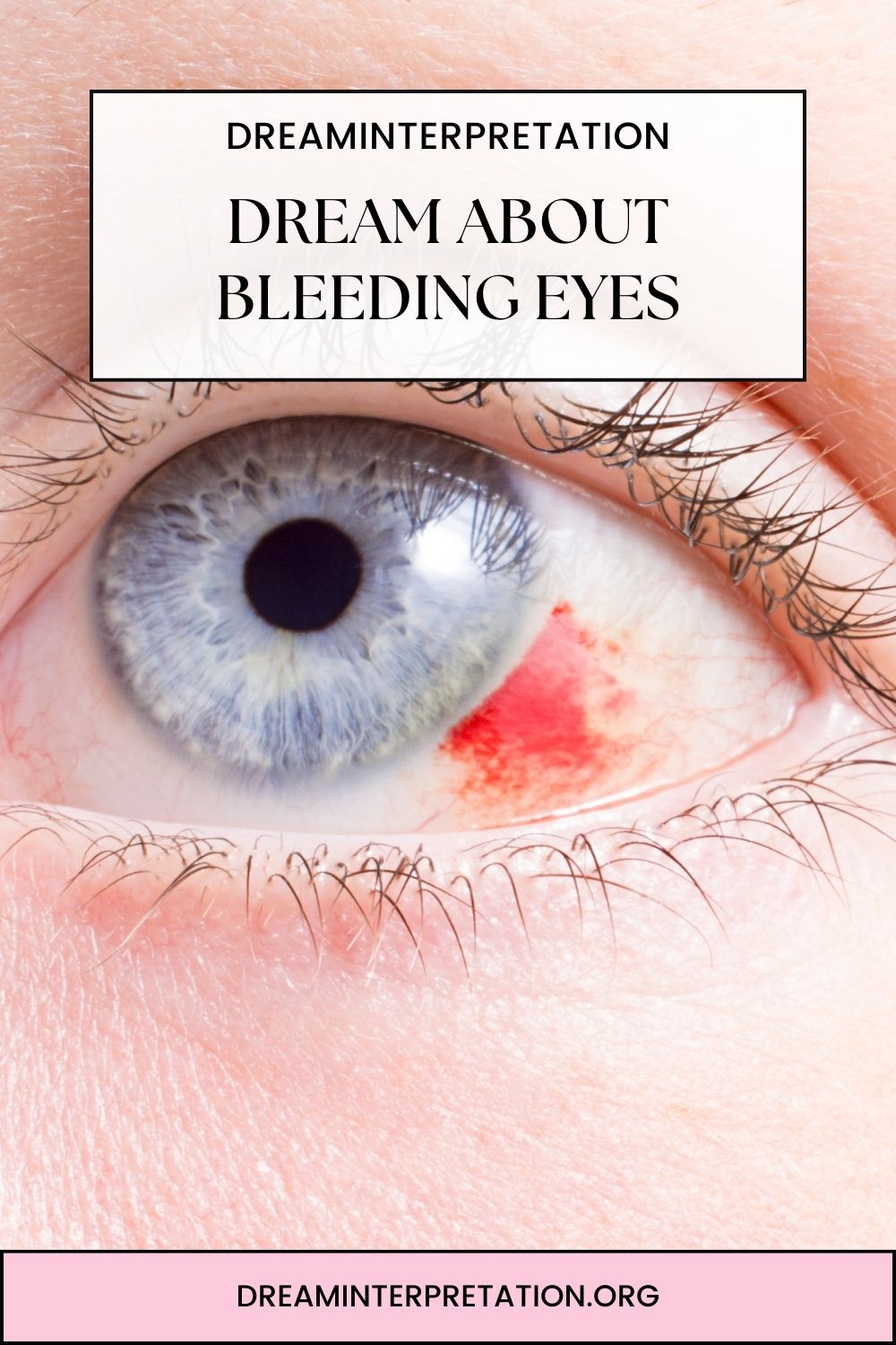 Dream About Bleeding Eyes pin 1