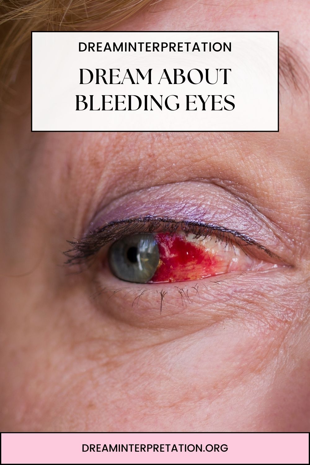 Dream About Bleeding Eyes pin 2