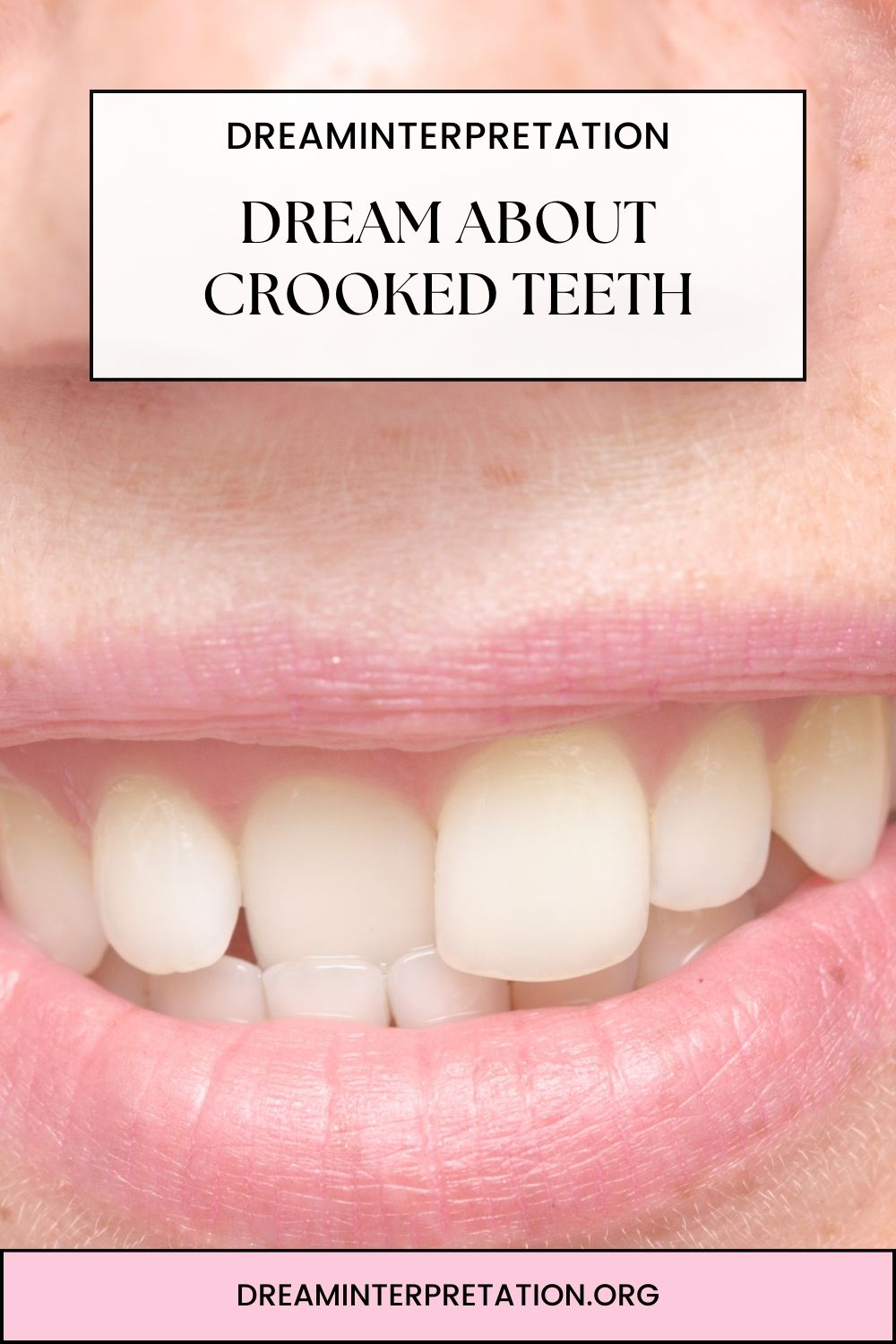 Dream About Crooked Teeth pin 2