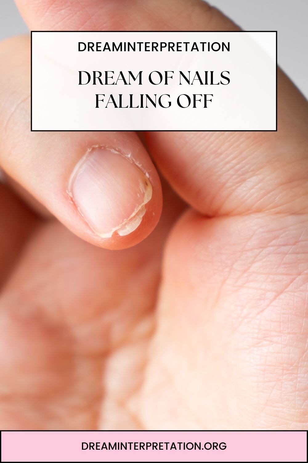 Dream of Nails Falling Off pin 2