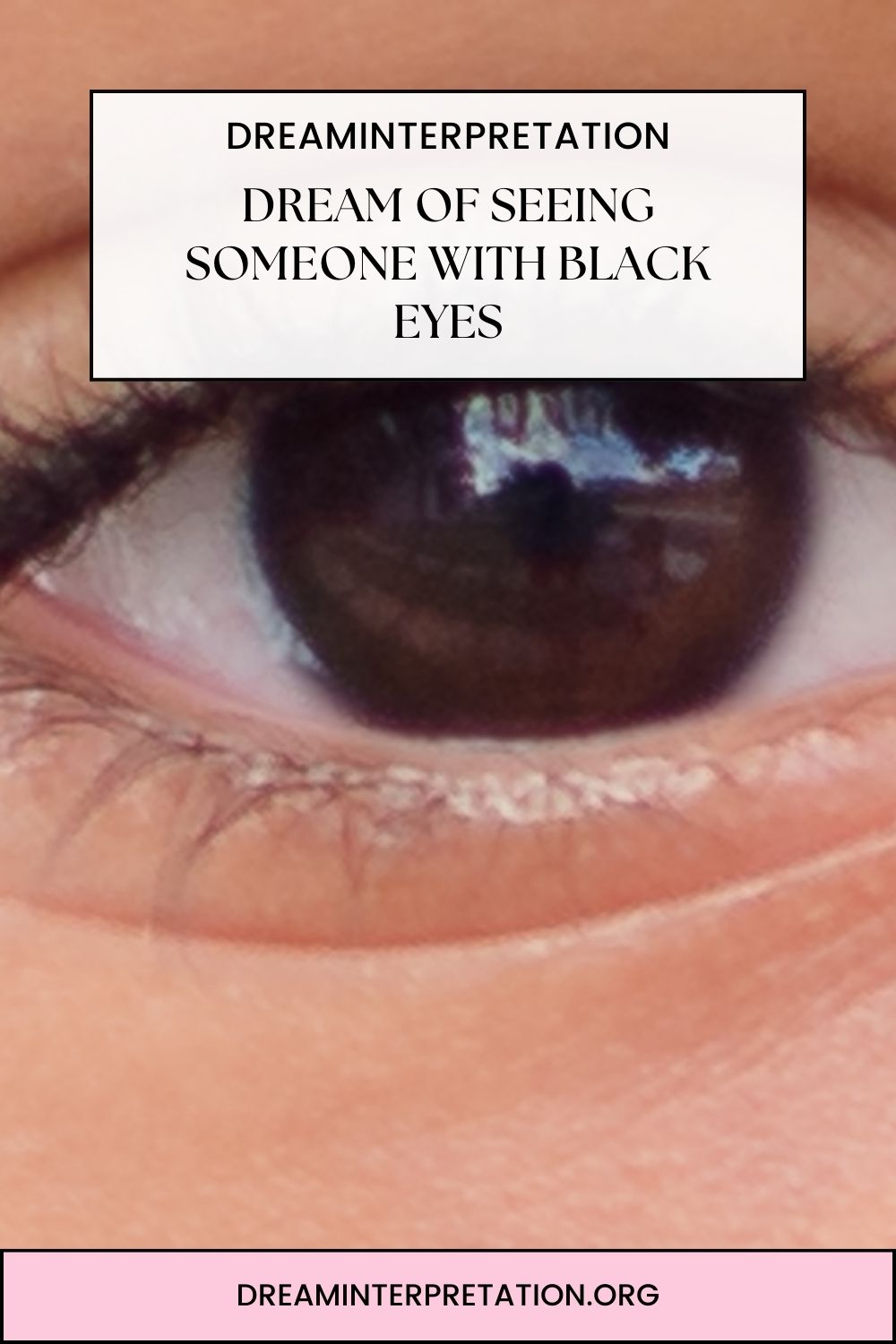 Dream of Seeing Someone With Black Eyes pin 1