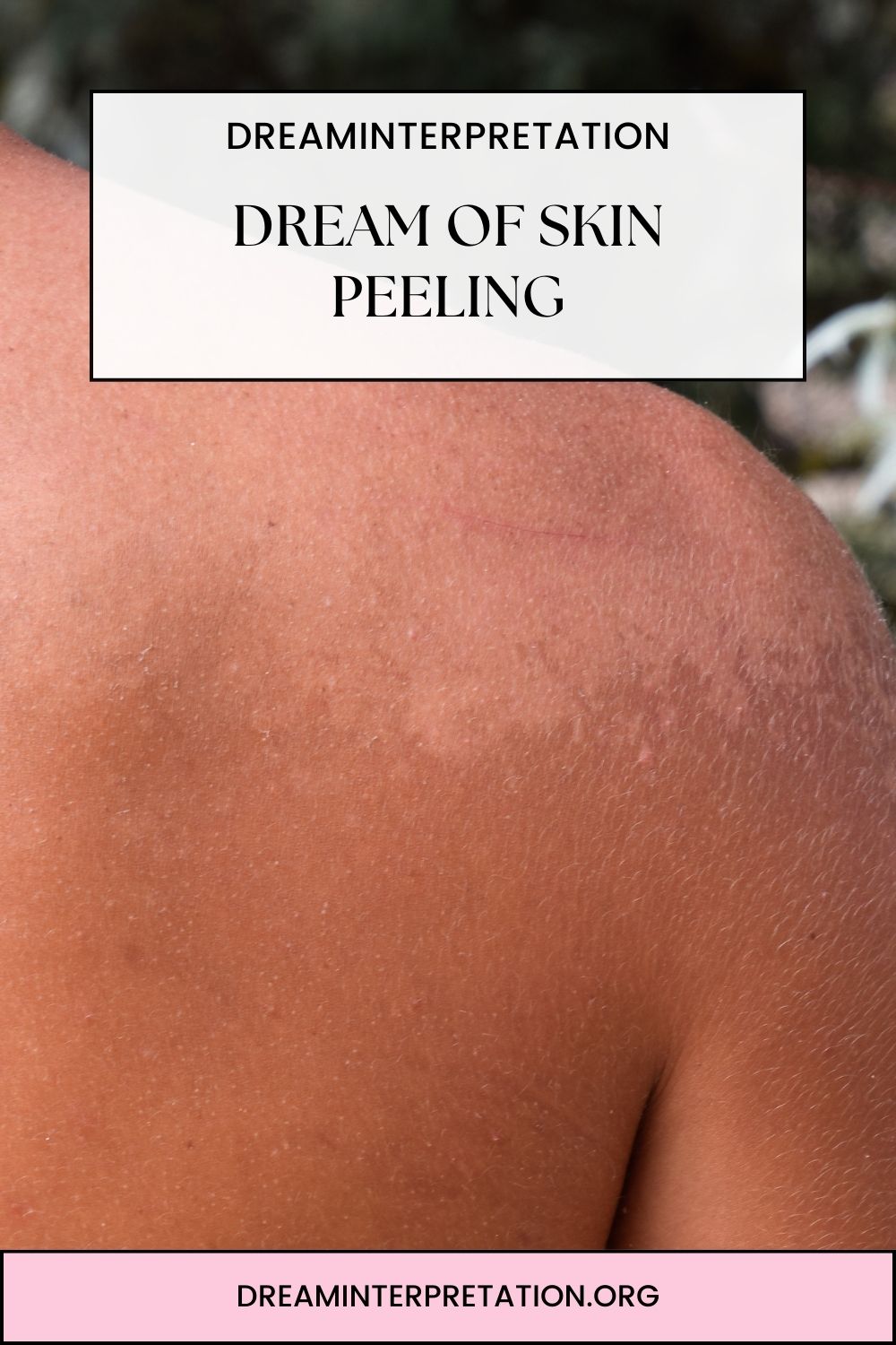 Dream of Skin Peeling pin 1